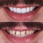 Newhall Dental Arts