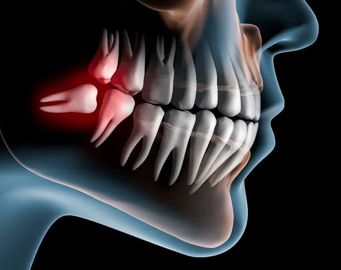 Pinnacle Peak Dental Center - Dr. Randy Lozada Picture 9