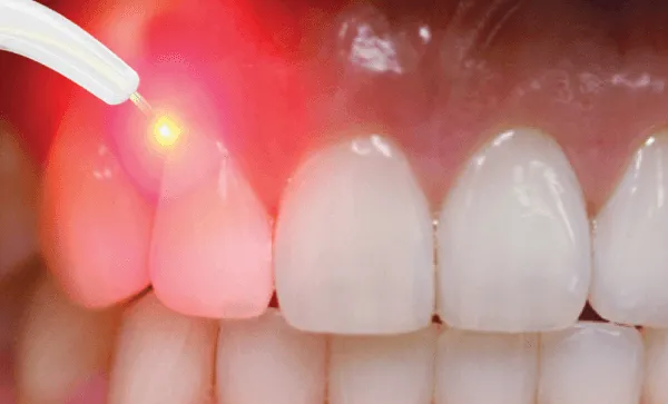 TMJ & Invisalign Woodland Hills Picture 9
