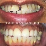 Cosmetic Dental Care of Santa Monica