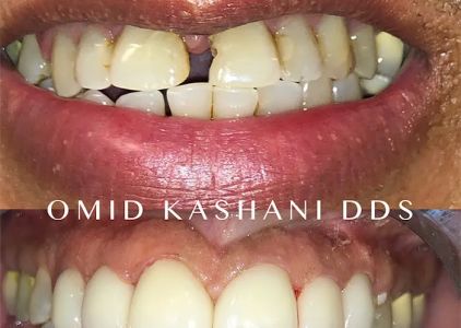 Cosmetic Dental Care of Santa Monica
