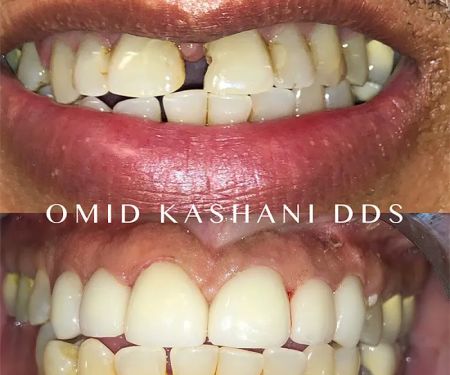 Cosmetic Dental Care of Santa Monica