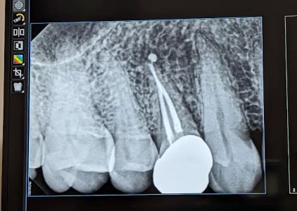 La Quinta Center for Cosmetic Dentistry