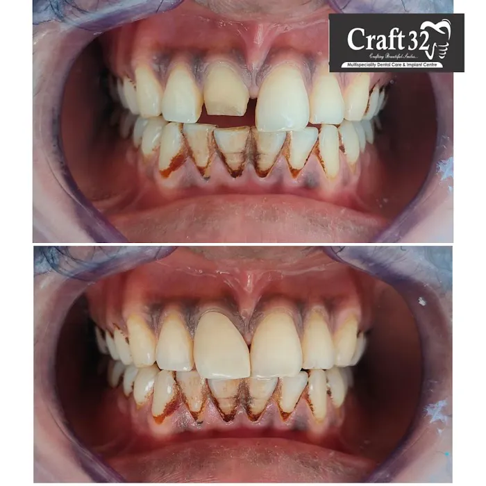 Craft32 Dental Care 10