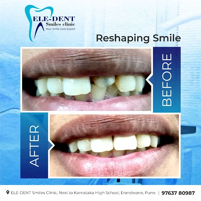 ELE-DENT Smiles Dental Clinic 6