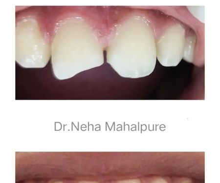 ELE-DENT Smiles Dental Clinic