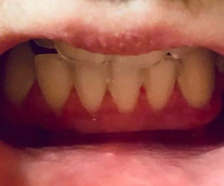 La Grange Periodontics
