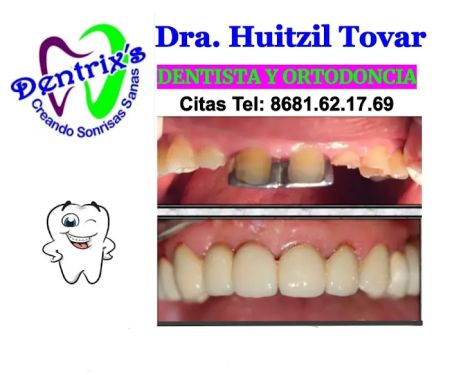 Dentrixs Dentista. Dra. Huitzil Tovar Ortodoncista