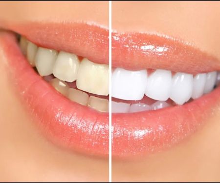 Bright Smile Family Dental