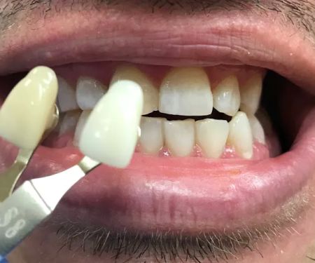 Dentistry On Thornhill Woods