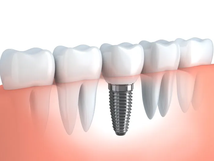Li Family Dental Picture 3
