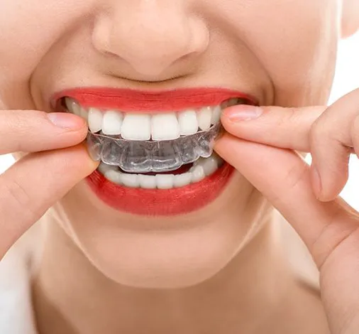 Eringate Dental Clinic | Dr. M. Victoria Razon-Clemente and Associates 2