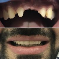Twogether Dental ico