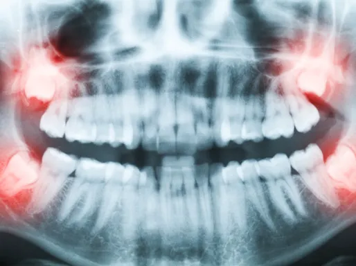 Markham Dental - General and Cosmetic Dentistry 3