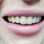 Aquadent Dental Care