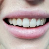 Aquadent Dental Care ico