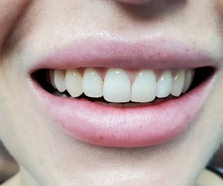 Aquadent Dental Care