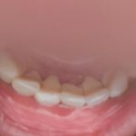 Toothworks Kilborn Dental Centre