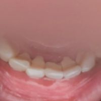 Toothworks Kilborn Dental Centre ico