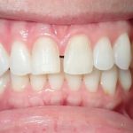 Reston Heights Dental