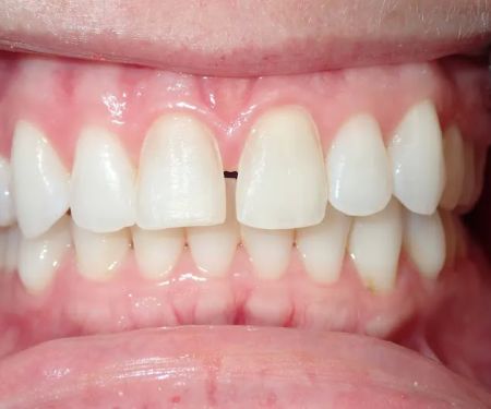 Reston Heights Dental