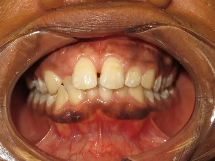 Waterdown Smiles Dentistry Picture 7