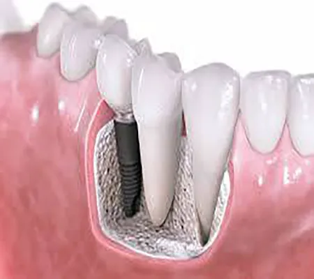 Reston Dental Care Picture 2