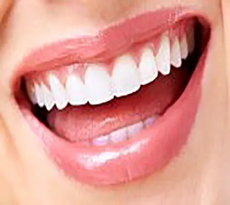 Reston Dental Care Picture 3