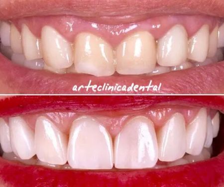ARTE CLINICA DENTAL