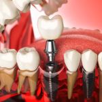 Smilee Dental Centre