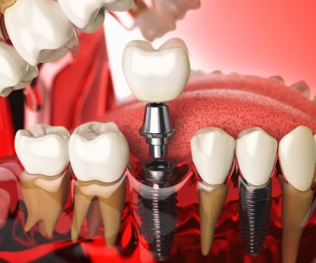 Smilee Dental Centre