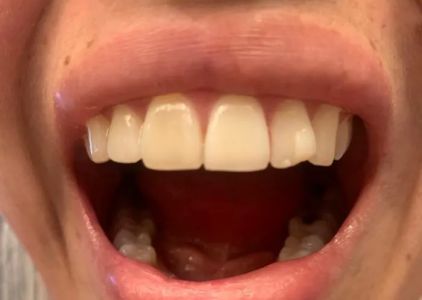 Kakaris Family Dentistry