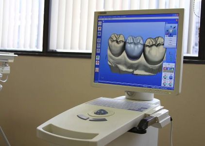 Widen Your Smile - Ronald R Widen, DDS
