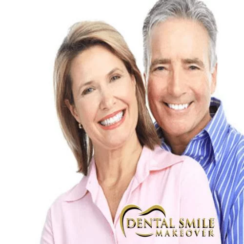 Dental Smile Makeover Picture 2