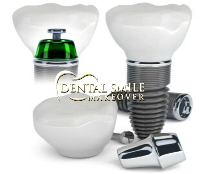 Dental Smile Makeover Picture 1