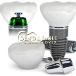 Dental Smile Makeover