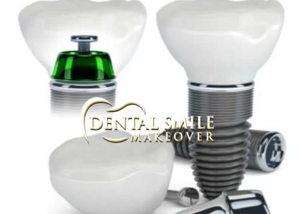 Dental Smile Makeover