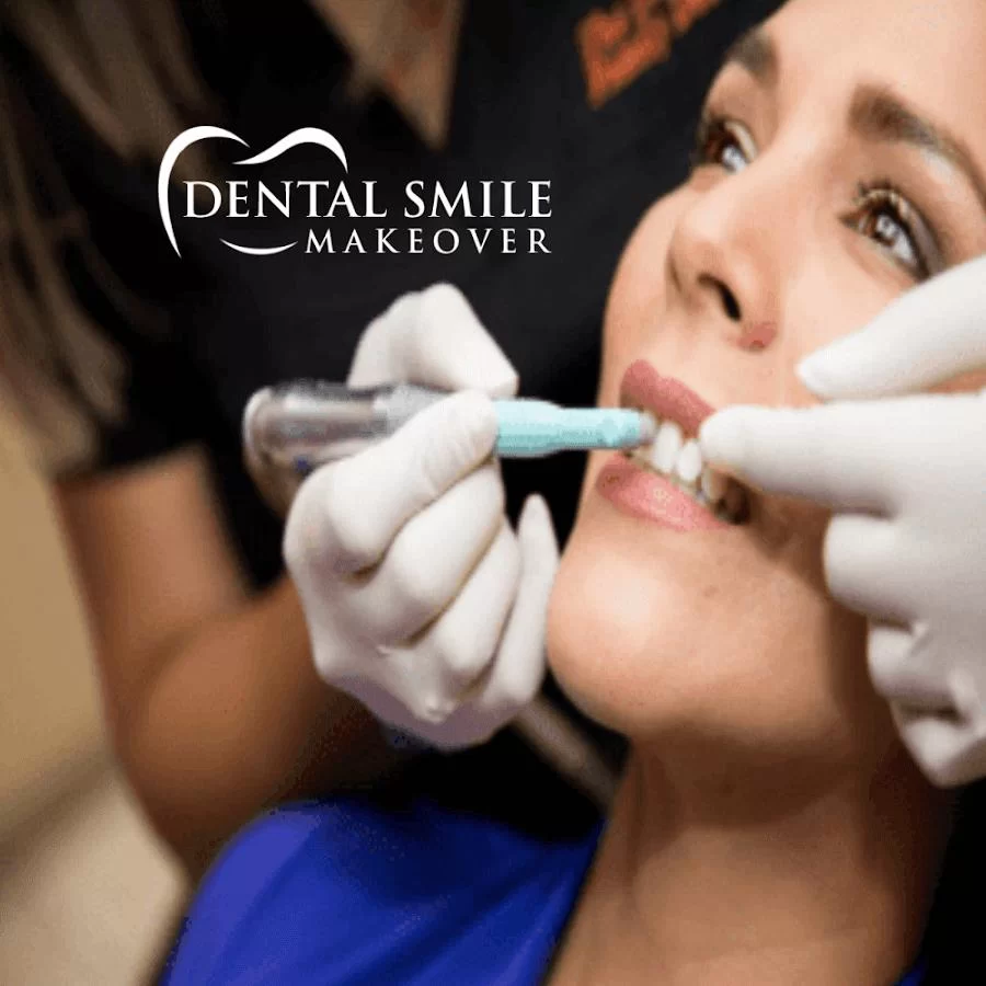 Dental Smile Makeover Picture 4