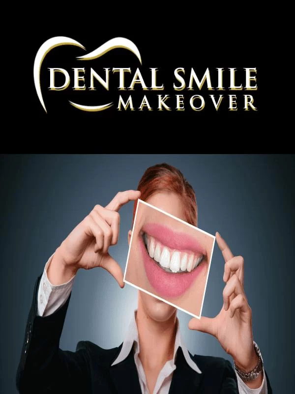 Dental Smile Makeover Picture 8