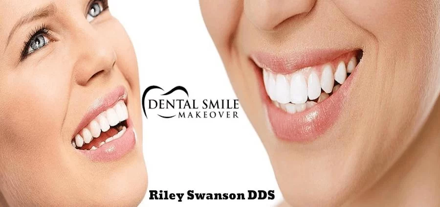 Dental Smile Makeover Picture 9