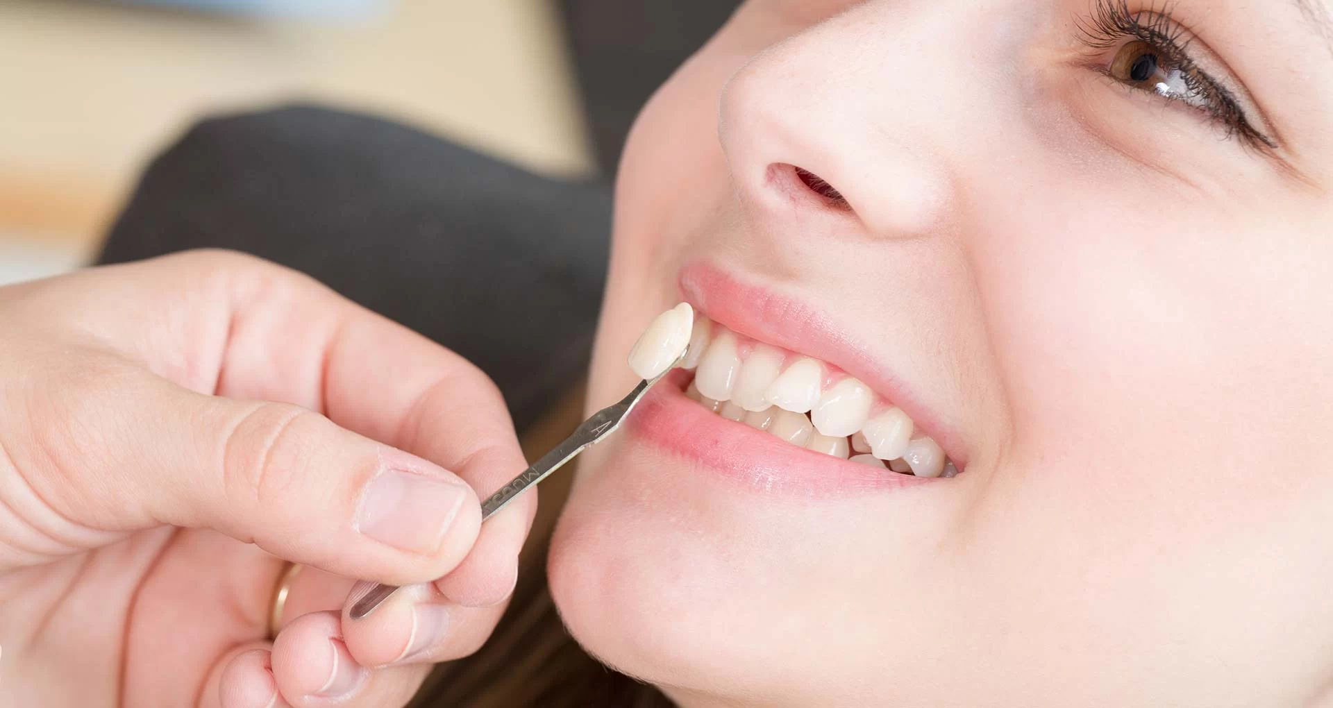 Can Dental Veneers Be Repaired? Everything You Need to Know