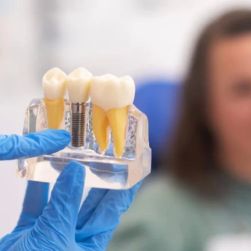 Alternatives to Traditional Dental Crowns: Exploring New Options for Tooth Restoration