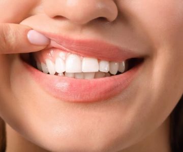 Effective Gum Disease Treatment: How to Combat Periodontal Disease and Protect Your Smile