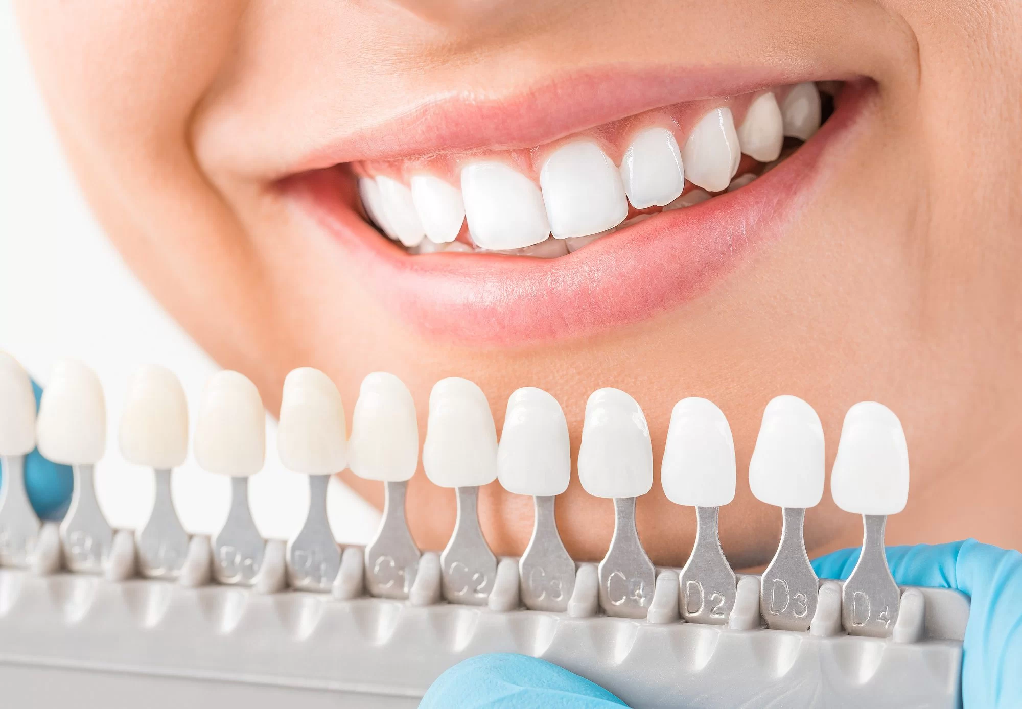 What Are Dental Crowns Used For? Exploring Their Purpose and Benefits