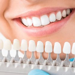 What Are Dental Crowns Used For? Exploring Their Purpose and Benefits