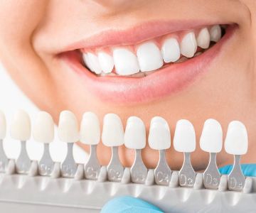 What Are Dental Crowns Used For? Exploring Their Purpose and Benefits