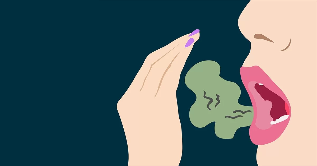 How to Treat Bad Breath: Effective Solutions and Causes of Halitosis