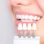 Advantages of Porcelain Dental Restorations
