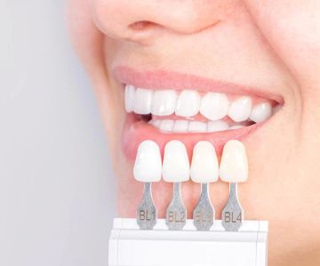 Advantages of Porcelain Dental Restorations