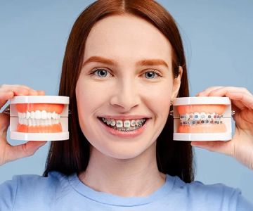 What Is the Best Dental Plan for Someone with Braces? Coverage & Costs